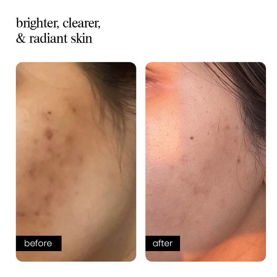 Correcting Concentrate